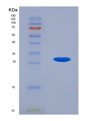 SDS-PAGE analysis of Human ANGPTL2 (Angiopoietin-Related Protein 2) - Recombinant Protein, CAT# BLT-00153P, showing >85% purity under 15% SDS-PAGE (Reduced)Human ANGPTL2 (Angiopoietin-Related Protein 2) - Recombinant Protein