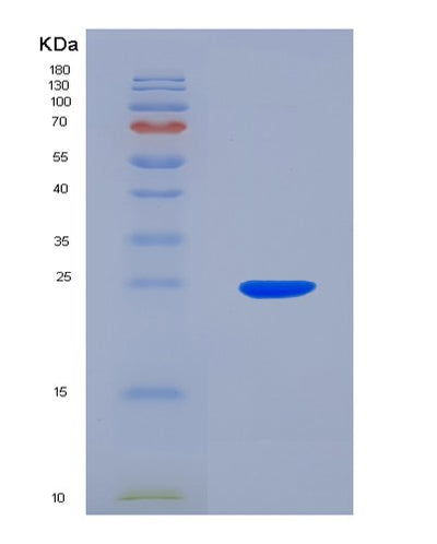 SDS-PAGE analysis of Human CADPS (Calcium-Dependent Secretion Activator 1) - Recombinant Protein, CAT# BLT-00406P, showing >90% purity under 15% SDS-PAGE (Reduced)Human CADPS (Calcium-Dependent Secretion Activator 1) - Recombinant Protein