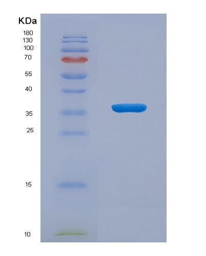 SDS-PAGE analysis of Human PADI4 (Protein-Arginine Deiminase Type-4) - Recombinant Protein, CATHuman PADI4 (Protein-Arginine Deiminase Type-4) - Recombinant Protein