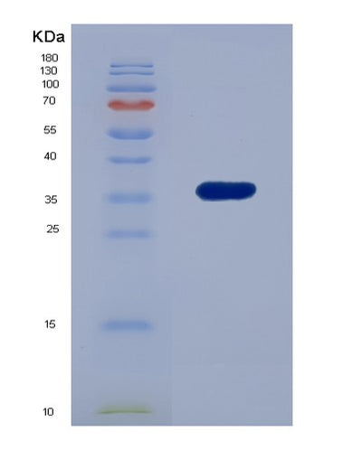 SDS-PAGE analysis of Human EDAR (Tumor Necrosis Factor Receptor Superfamily Member Edar) - Recombinant Protein, CAT# BLT-00928P, showing >85% purity under 15% SDS-PAGE (Reduced)Human EDAR (Tumor Necrosis Factor Receptor Superfamily Member Edar) - Recombinant Protein