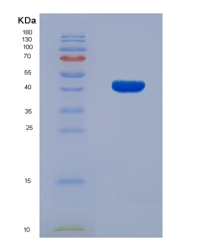 SDS-PAGE analysis of Human PSMD13 (26S Proteasome Non-Atpase Regulatory Subunit 13) - Recombinant Protein, CATHuman PSMD13 (26S Proteasome Non-Atpase Regulatory Subunit 13) - Recombinant Protein