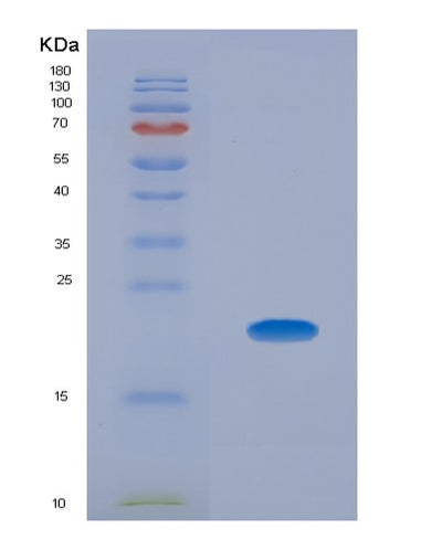 SDS-PAGE analysis of Human PROCR (Endothelial Protein C Receptor) - Recombinant Protein, CAT# BLT-02385P, showing >85% purity under 15% SDS-PAGE (Reduced)Human PROCR (Endothelial Protein C Receptor) - Recombinant Protein