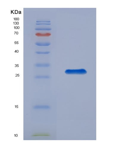SDS-PAGE analysis of Human PPIE (Peptidyl-Prolyl Cis-Trans Isomerase E) - Recombinant Protein, CAT# BLT-02343P, showing >85% purity under 15% SDS-PAGE (Reduced)Human PPIE (Peptidyl-Prolyl Cis-Trans Isomerase E) - Recombinant Protein