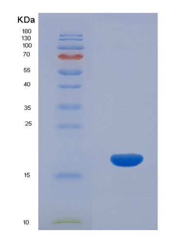 SDS-PAGE analysis of Human CCL26 (C-C Motif Chemokine 26) - Recombinant Protein, CAT# BLT-00446P, showing >90% purity under 15% SDS-PAGE (Reduced)Human CCL26 (C-C Motif Chemokine 26) - Recombinant Protein