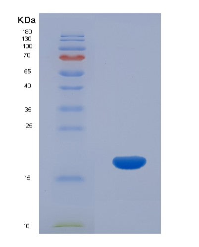 SDS-PAGE analysis of Human CCL26 (C-C Motif Chemokine 26) - Recombinant Protein, CATHuman CCL26 (C-C Motif Chemokine 26) - Recombinant Protein
