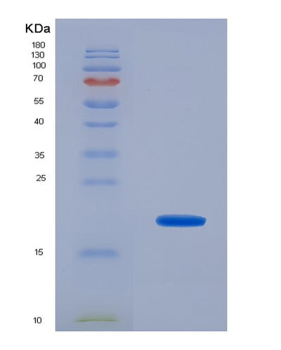 SDS-PAGE analysis of Human NUDC (Nuclear Migration Protein Nudc) - Recombinant Protein, CAT# BLT-02087P, showing >95% purity under 15% SDS-PAGE (Reduced)Human NUDC (Nuclear Migration Protein Nudc) - Recombinant Protein