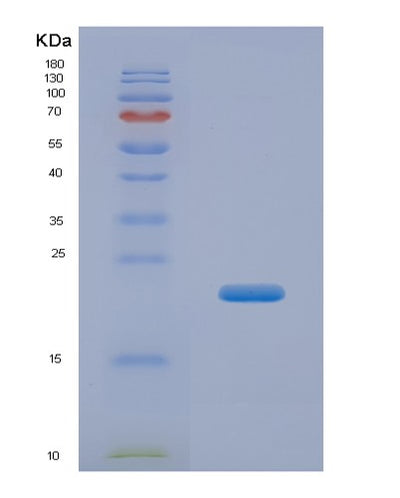 SDS-PAGE analysis of Human CFL2 (Cofilin-2) - Recombinant Protein, CAT# BLT-00576P, showing >95% purity under 15% SDS-PAGE (Reduced)Human CFL2 (Cofilin-2) - Recombinant Protein