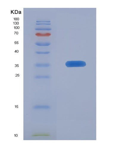 SDS-PAGE analysis of Human CA5B (Carbonic Anhydrase 5B, Mitochondrial) - Recombinant Protein, CAT# BLT-05692P, showing >95% purity under 15% SDS-PAGE (Reduced)Human CA5B (Carbonic Anhydrase 5B, Mitochondrial) - Recombinant Protein