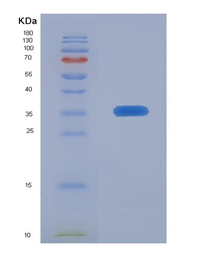 SDS-PAGE analysis of Human CA5B (Carbonic Anhydrase 5B, Mitochondrial) - Recombinant Protein, CATHuman CA5B (Carbonic Anhydrase 5B, Mitochondrial) - Recombinant Protein