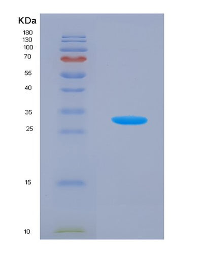 SDS-PAGE analysis of Human KLK5 (Kallikrein-5) - Recombinant Protein, CAT# BLT-01647P, showing >90% purity under 15% SDS-PAGE (Reduced)Human KLK5 (Kallikrein-5) - Recombinant Protein