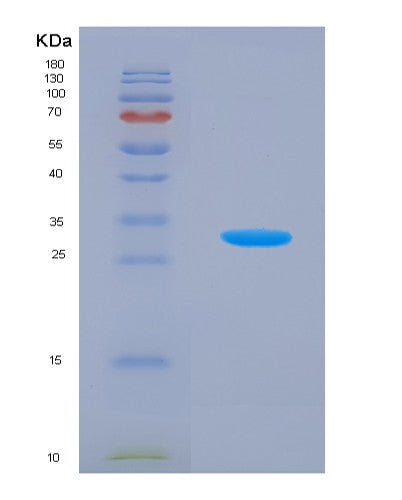 SDS-PAGE analysis of Human KLK5 (Kallikrein-5) - Recombinant Protein, CATHuman KLK5 (Kallikrein-5) - Recombinant Protein