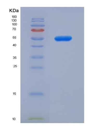 SDS-PAGE analysis of Human PRKAB1 (5'-Amp-Activated Protein Kinase Subunit Beta-1) - Recombinant Protein, CAT# BLT-02372P, showing >90% purity under 15% SDS-PAGE (Reduced)Human PRKAB1 (5'-Amp-Activated Protein Kinase Subunit Beta-1) - Recombinant Protein