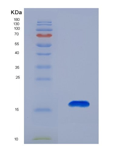 SDS-PAGE analysis of Human CCL27 (C-C Motif Chemokine 27) - Recombinant Protein, CATHuman CCL27 (C-C Motif Chemokine 27) - Recombinant Protein