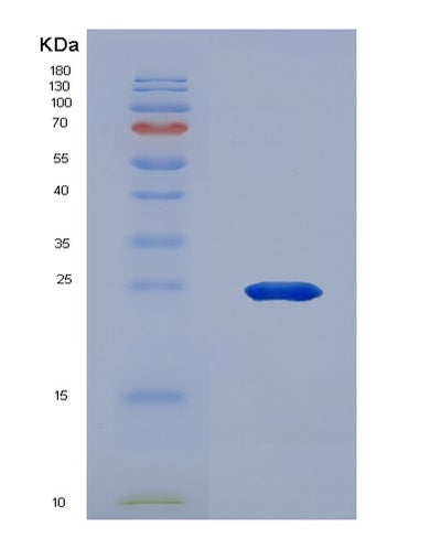 SDS-PAGE analysis of Human ANGPTL3 (Angiopoietin-Related Protein 3) - Recombinant Protein, CAT# BLT-00155P, showing >90% purity under 15% SDS-PAGE (Reduced)Human ANGPTL3 (Angiopoietin-Related Protein 3) - Recombinant Protein