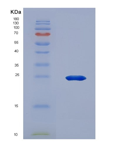 SDS-PAGE analysis of Human ANGPTL3 (Angiopoietin-Related Protein 3) - Recombinant Protein, CATHuman ANGPTL3 (Angiopoietin-Related Protein 3) - Recombinant Protein