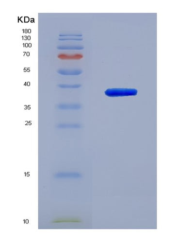 SDS-PAGE analysis of Human UCHL5 (Ubiquitin Carboxyl-Terminal Hydrolase Isozyme L5) - Recombinant Protein, CAT# BLT-03229P, showing >85% purity under 15% SDS-PAGE (Reduced)Human UCHL5 (Ubiquitin Carboxyl-Terminal Hydrolase Isozyme L5) - Recombinant Protein
