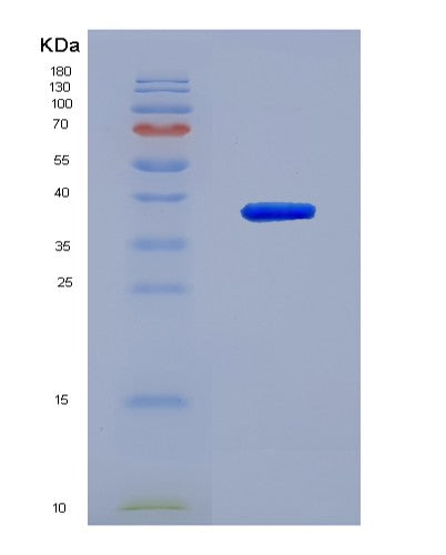 SDS-PAGE analysis of Human UCHL5 (Ubiquitin Carboxyl-Terminal Hydrolase Isozyme L5) - Recombinant Protein, CATHuman UCHL5 (Ubiquitin Carboxyl-Terminal Hydrolase Isozyme L5) - Recombinant Protein