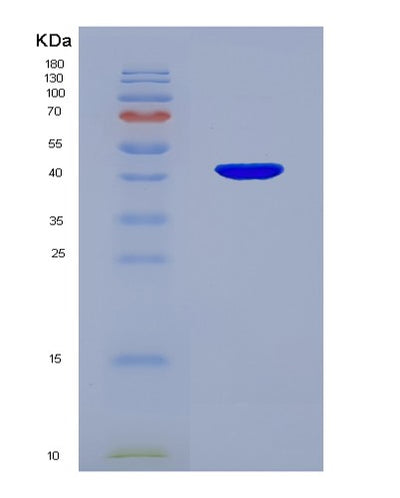 SDS-PAGE analysis of Human WIF1 (Wnt Inhibitory Factor 1) - Recombinant Protein, CAT# BLT-03313P, showing >85% purity under 15% SDS-PAGE (Reduced)Human WIF1 (Wnt Inhibitory Factor 1) - Recombinant Protein