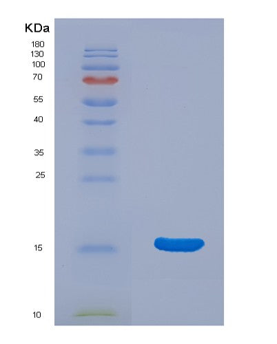SDS-PAGE analysis of Human HCFC2 (Host Cell Factor 2) - Recombinant Protein, CATHuman HCFC2 (Host Cell Factor 2) - Recombinant Protein