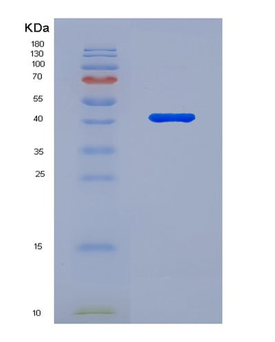 SDS-PAGE analysis of Human PSAT1 (Phosphoserine Aminotransferase) - Recombinant Protein, CAT# BLT-02403P, showing >95% purity under 15% SDS-PAGE (Reduced)Human PSAT1 (Phosphoserine Aminotransferase) - Recombinant Protein