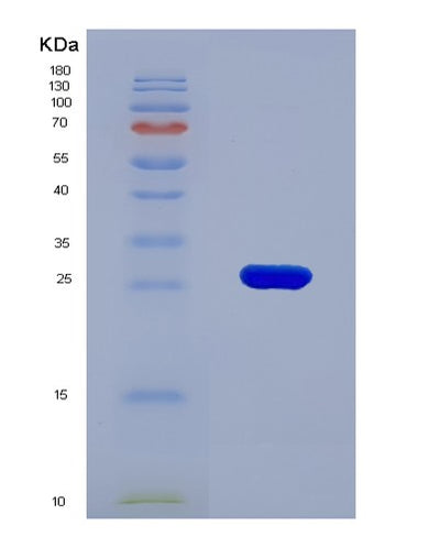 SDS-PAGE analysis of Human F11R (Junctional Adhesion Molecule A) - Recombinant Protein, CAT# BLT-01026P, showing >90% purity under 15% SDS-PAGE (Reduced)Human F11R (Junctional Adhesion Molecule A) - Recombinant Protein