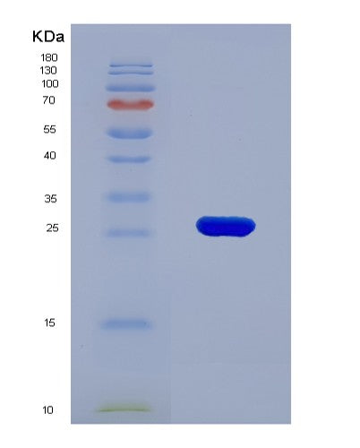 SDS-PAGE analysis of Human F11R (Junctional Adhesion Molecule A) - Recombinant Protein, CATHuman F11R (Junctional Adhesion Molecule A) - Recombinant Protein