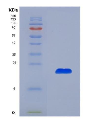 SDS-PAGE analysis of Human CLIC4 (Chloride Intracellular Channel Protein 4) - Recombinant Protein, CAT# BLT-00628P, showing >85% purity under 15% SDS-PAGE (Reduced)Human CLIC4 (Chloride Intracellular Channel Protein 4) - Recombinant Protein