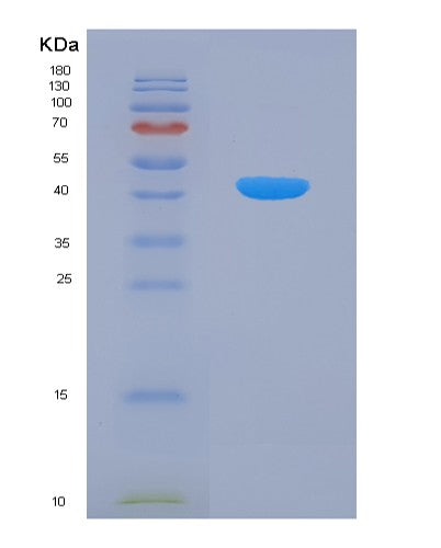 SDS-PAGE analysis of Human TNFSF13B (Tumor Necrosis Factor Ligand Superfamily Member 13B) - Recombinant Protein, CATHuman TNFSF13B (Tumor Necrosis Factor Ligand Superfamily Member 13B) - Recombinant Protein