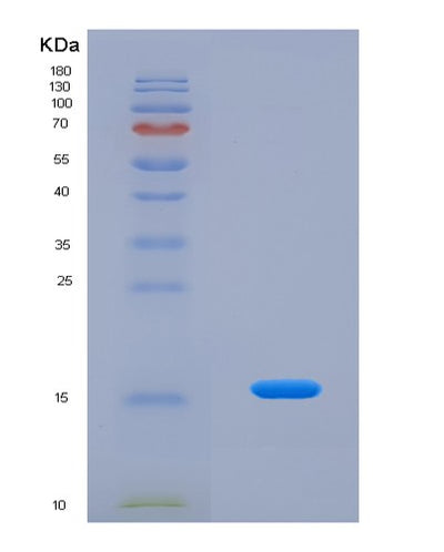 SDS-PAGE analysis of Human FABP4 (Fatty Acid-Binding Protein, Adipocyte) - Recombinant Protein, CAT# BLT-07787P, showing >90% purity under 15% SDS-PAGE (Reduced)Human FABP4 (Fatty Acid-Binding Protein, Adipocyte) - Recombinant Protein