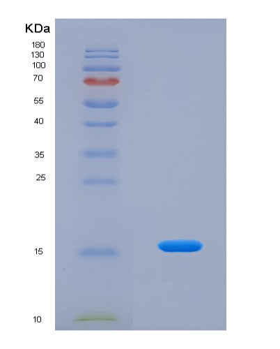 SDS-PAGE analysis of Human FABP4 (Fatty Acid-Binding Protein, Adipocyte) - Recombinant Protein, CATHuman FABP4 (Fatty Acid-Binding Protein, Adipocyte) - Recombinant Protein