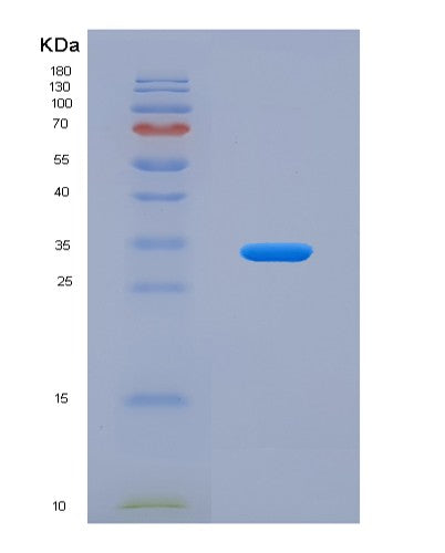 SDS-PAGE analysis of Human ITIH2 (Inter-Alpha-Trypsin Inhibitor Heavy Chain H2) - Recombinant Protein, CATHuman ITIH2 (Inter-Alpha-Trypsin Inhibitor Heavy Chain H2) - Recombinant Protein