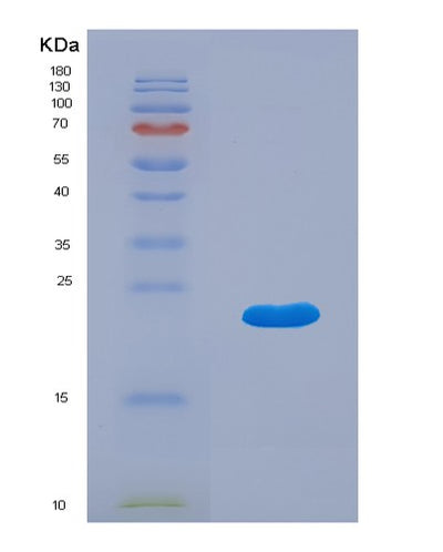 SDS-PAGE analysis of Human IFNA5 (Interferon Alpha-5) - Recombinant Protein, CAT# BLT-07790P, showing >90% purity under 15% SDS-PAGE (Reduced)Human IFNA5 (Interferon Alpha-5) - Recombinant Protein