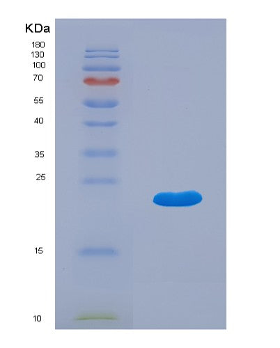 SDS-PAGE analysis of Human IFNA5 (Interferon Alpha-5) - Recombinant Protein, CATHuman IFNA5 (Interferon Alpha-5) - Recombinant Protein