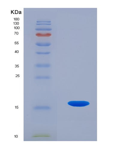SDS-PAGE analysis of Human PTN (Pleiotrophin) - Recombinant Protein, CAT# BLT-07791P, showing >90% purity under 15% SDS-PAGE (Reduced)Human PTN (Pleiotrophin) - Recombinant Protein