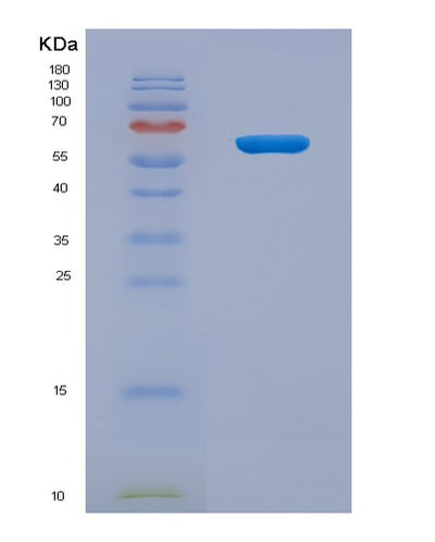 SDS-PAGE analysis of Human HJV (Hemojuvelin) - Recombinant Protein, CAT# BLT-07792P, showing >90% purity under 15% SDS-PAGE (Reduced)Human HJV (Hemojuvelin) - Recombinant Protein