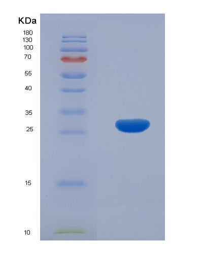SDS-PAGE analysis of Mouse Sh2b3 (Sh2B Adapter Protein 3) - Recombinant Protein, CATMouse Sh2b3 (Sh2B Adapter Protein 3) - Recombinant Protein