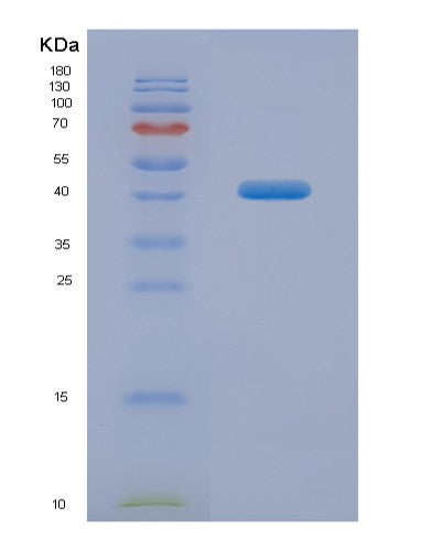 SDS-PAGE analysis of Human MFN1 (Mitofusin-1) - Recombinant Protein, CATHuman MFN1 (Mitofusin-1) - Recombinant Protein