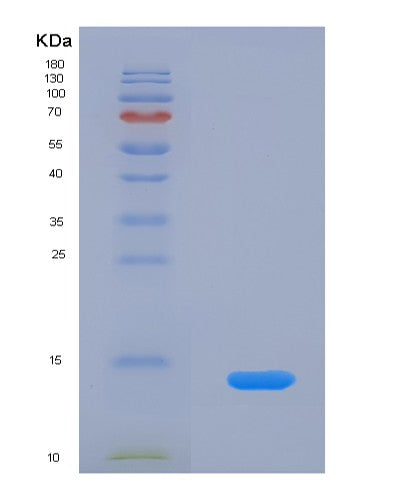 SDS-PAGE analysis of Human CCL3 (C-C Motif Chemokine 3) - Recombinant Protein, CATHuman CCL3 (C-C Motif Chemokine 3) - Recombinant Protein