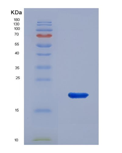 SDS-PAGE analysis of Human COL18A1 (Collagen Alpha-1(Xviii) Chain) - Recombinant Protein, CAT# BLT-07801P, showing >90% purity under 15% SDS-PAGE (Reduced)Human COL18A1 (Collagen Alpha-1(Xviii) Chain) - Recombinant Protein