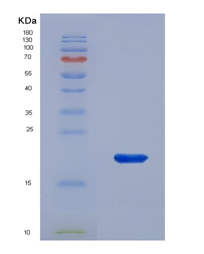 SDS-PAGE analysis of Human COL18A1 (Collagen Alpha-1(Xviii) Chain) - Recombinant Protein, CATHuman COL18A1 (Collagen Alpha-1(Xviii) Chain) - Recombinant Protein