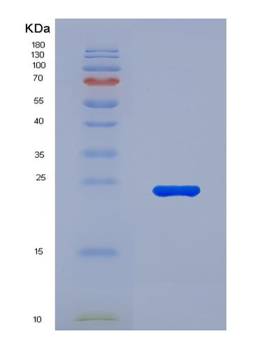 SDS-PAGE analysis of Human IL11 (Interleukin-11) - Recombinant Protein, CAT# BLT-07805P, showing >90% purity under 15% SDS-PAGE (Reduced)Human IL11 (Interleukin-11) - Recombinant Protein