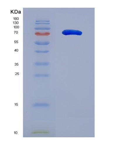 SDS-PAGE analysis of Human MMP2 (72 Kda Type Iv Collagenase) - Recombinant Protein, CAT# BLT-07806P, showing >90% purity under 15% SDS-PAGE (Reduced)Human MMP2 (72 Kda Type Iv Collagenase) - Recombinant Protein