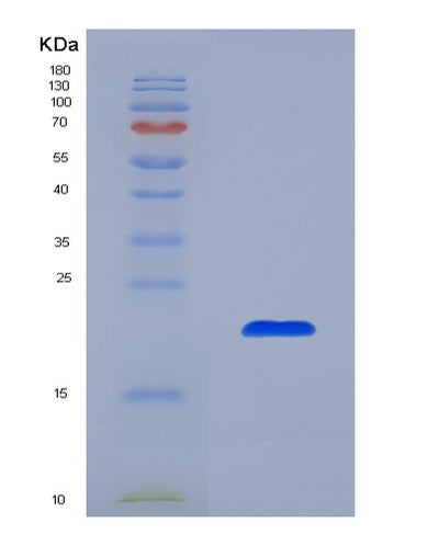 SDS-PAGE analysis of Human SHBG (Sex Hormone-Binding Globulin) - Recombinant Protein, CAT# BLT-07807P, showing >90% purity under 15% SDS-PAGE (Reduced)Human SHBG (Sex Hormone-Binding Globulin) - Recombinant Protein