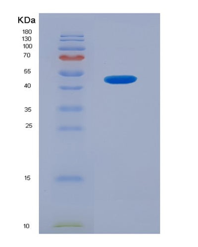 SDS-PAGE analysis of Human SHBG (Sex Hormone-Binding Globulin) - Recombinant Protein, CAT# BLT-07808P, showing >90% purity under 15% SDS-PAGE (Reduced)Human SHBG (Sex Hormone-Binding Globulin) - Recombinant Protein