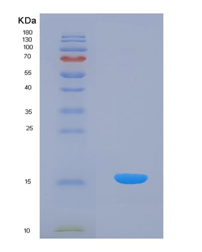 SDS-PAGE analysis of Human CDA (Cytidine Deaminase) - Recombinant Protein, CAT# BLT-07809P, showing >90% purity under 15% SDS-PAGE (Reduced)Human CDA (Cytidine Deaminase) - Recombinant Protein