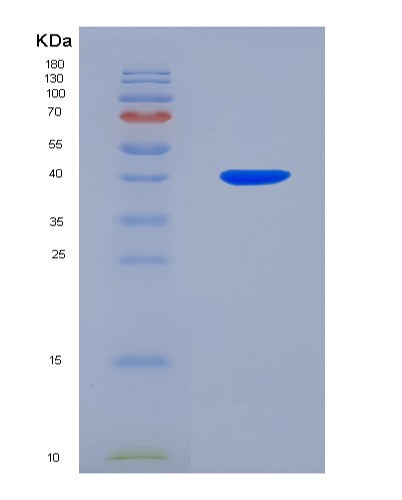 SDS-PAGE analysis of Human PLTP (Phospholipid Transfer Protein) - Recombinant Protein, CATHuman PLTP (Phospholipid Transfer Protein) - Recombinant Protein