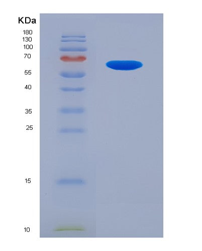 SDS-PAGE analysis of Mouse Agt (Angiotensinogen) - Recombinant Protein, CATMouse Agt (Angiotensinogen) - Recombinant Protein