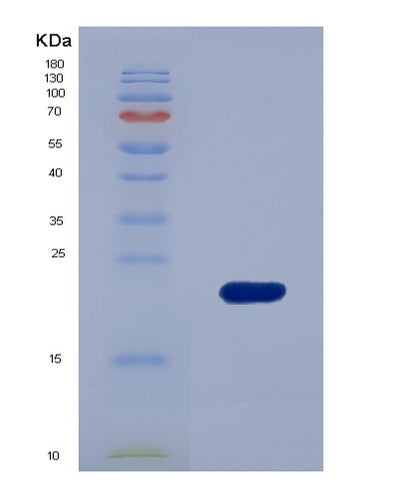 SDS-PAGE analysis of Human MANF (Mesencephalic Astrocyte-Derived Neurotrophic Factor) - Recombinant Protein, CAT# BLT-07817P, showing >90% purity under 15% SDS-PAGE (Reduced)Human MANF (Mesencephalic Astrocyte-Derived Neurotrophic Factor) - Recombinant Protein