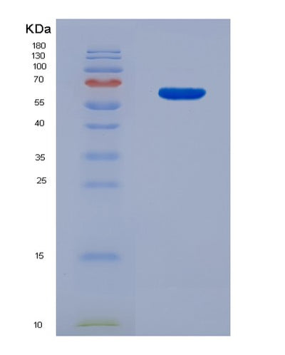 SDS-PAGE analysis of Mouse Usp14 (Ubiquitin Carboxyl-Terminal Hydrolase 14) - Recombinant Protein, CAT# BLT-07818P, showing >90% purity under 15% SDS-PAGE (Reduced)Mouse Usp14 (Ubiquitin Carboxyl-Terminal Hydrolase 14) - Recombinant Protein