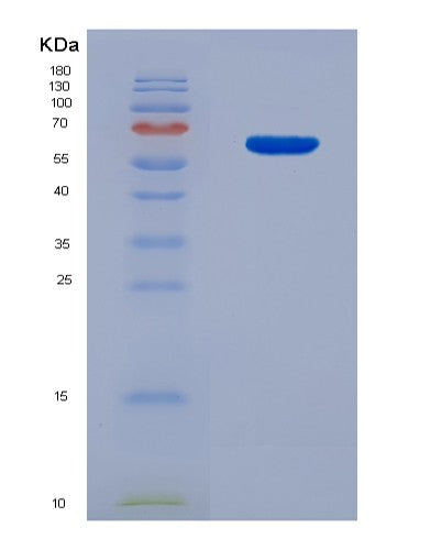 SDS-PAGE analysis of Mouse Usp14 (Ubiquitin Carboxyl-Terminal Hydrolase 14) - Recombinant Protein, CATMouse Usp14 (Ubiquitin Carboxyl-Terminal Hydrolase 14) - Recombinant Protein